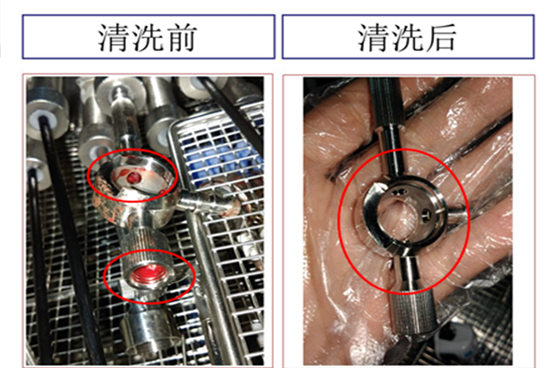 醫用器械精密清洗丨超聲波清洗機進行了哪些創新